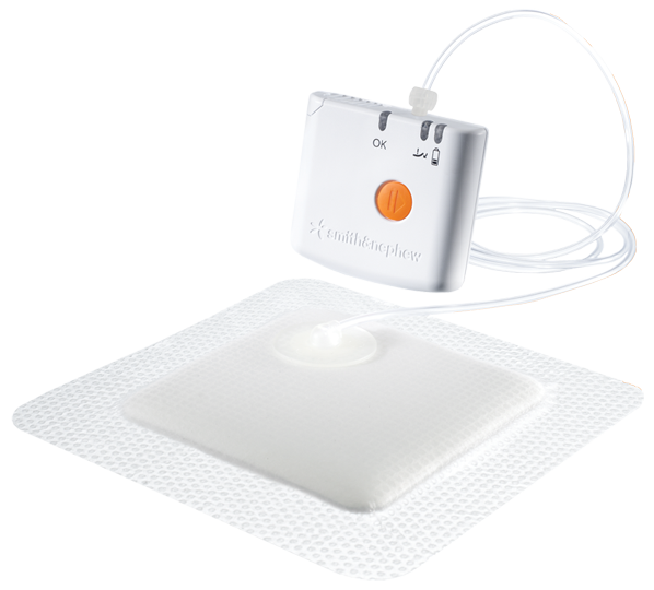 PICO Negative Pressure Wound Therapy McKesson